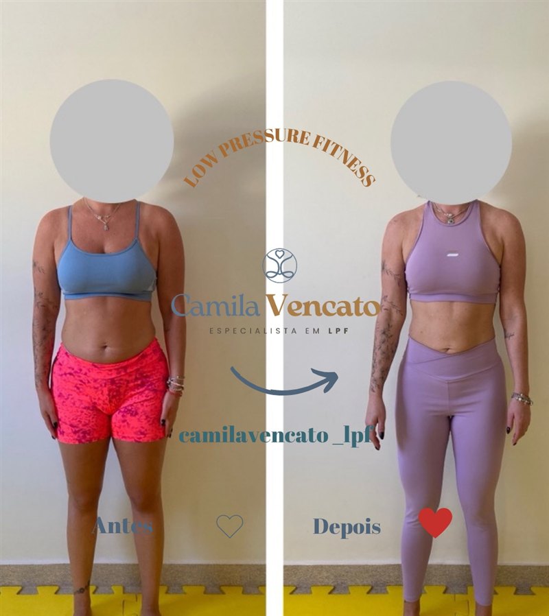 Antes e depois do corpo inteiro, vista de frente, de uma aluna do Método LPF com Camila Vencato