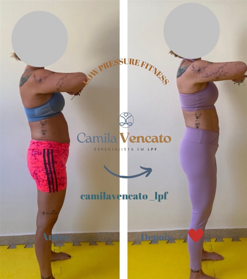 Antes e depois do corpo inteiro, vista de lado, de uma aluna do Método LPF com Camila Vencato