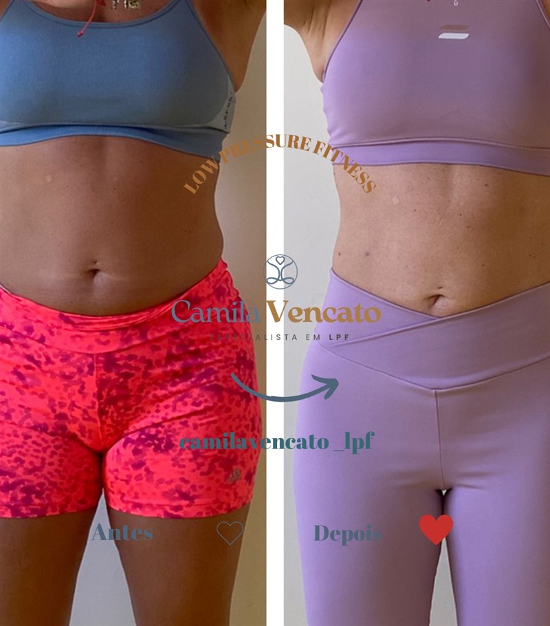Antes e depois no torso, vista de frente, de uma aluna do Método LPF com Camila Vencato
