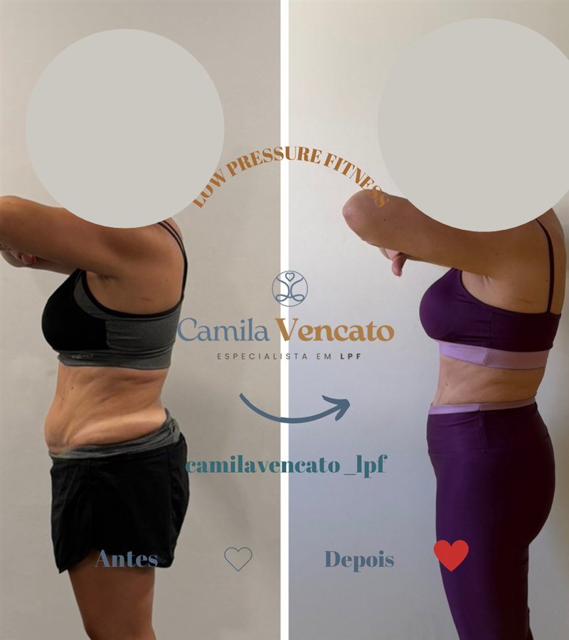 Antes e depois no torso, vista de lado, de uma aluna do Método LPF com Camila Vencato