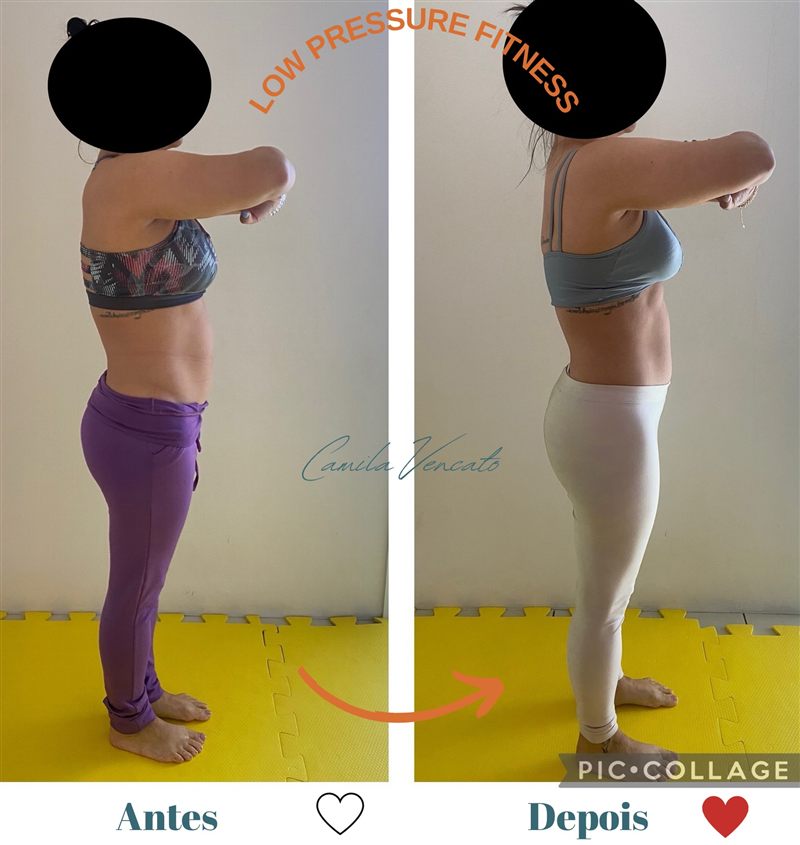 Antes e depois do corpo inteiro, vista de lado, de uma aluna do Método LPF com Camila Vencato
